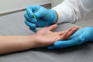 Cirugía de intervencionismo: ¿qué es y cómo evita el quirófano tradicional?