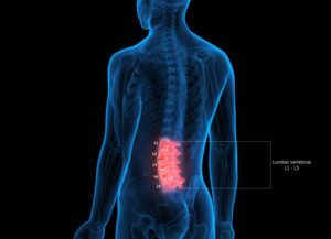 Atención inmediata para lumbalgia aguda con especialista en dolor de espalda